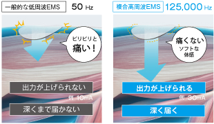 複合高周波EMS